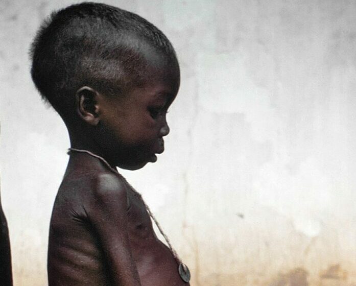  Mais de um milhão de angolanos enfrenta problemas de insegurança alimentar aguda, revela relatório da ONU