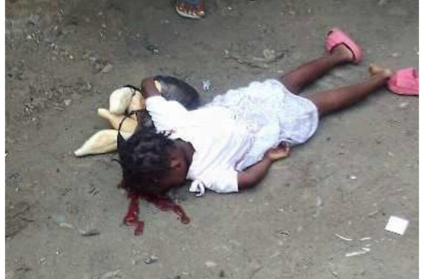 Criança de seis anos é internada às pressas no Josina Machel após tiro acidental de um efectivo da Polícia Nacional no bairro São Pedro da Barra