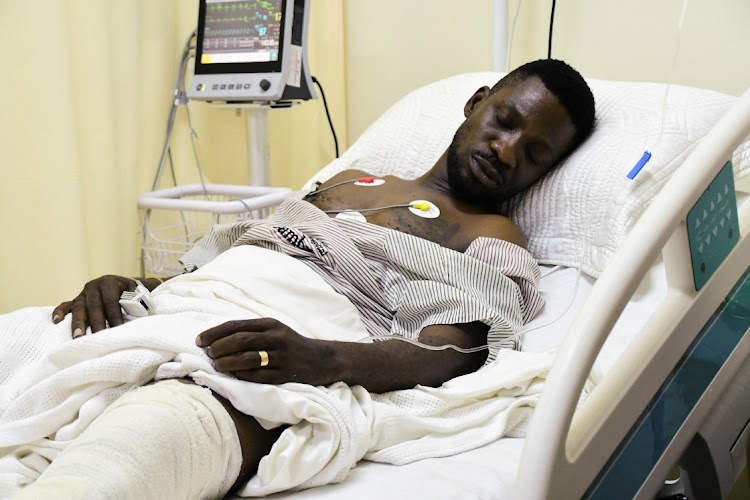  Uganda. Líder da oposição estável após ser atingido pela polícia